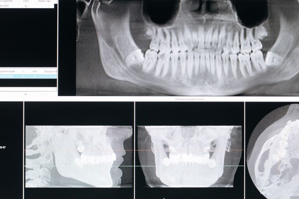 ¿Cómo automatizar la recepción y las citas de una clínica dental con IA?