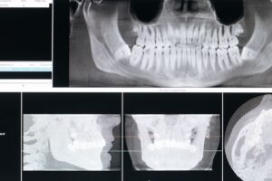 ¿Cómo automatizar la recepción y las citas de una clínica dental con IA?